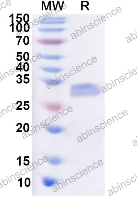 Human PNPLA4 Recombinant Protein (N-His)