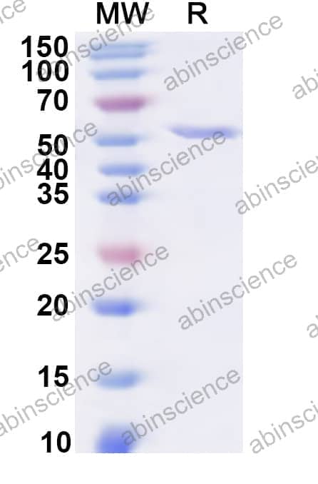 Human TEC Recombinant Protein (N-His)