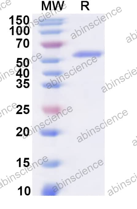 Human MATK Recombinant Protein (N-His)