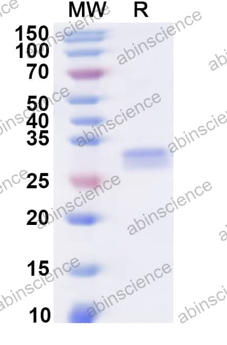 Human PTGIR Recombinant Protein (N-His-KSI)