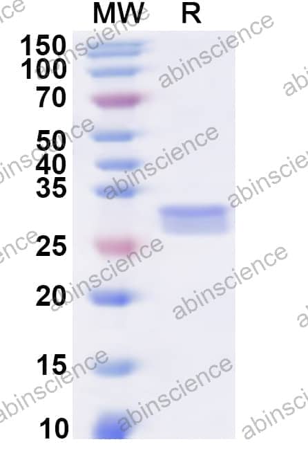 Human SLC1A4 Recombinant Protein (N-His-KSI)