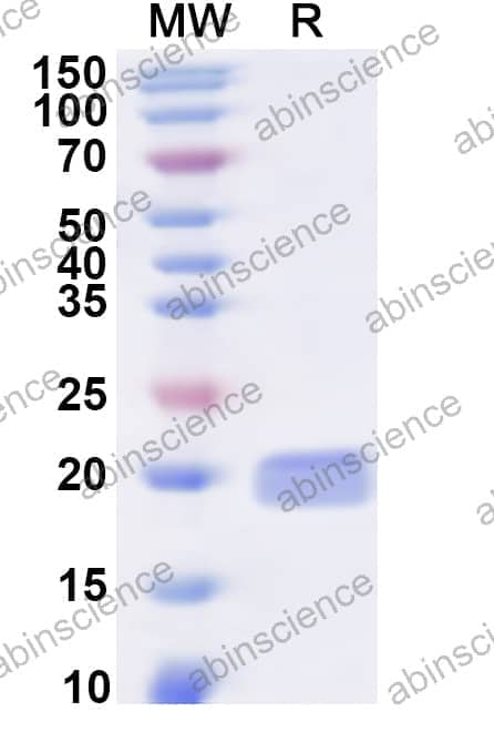 Human CDKN2C Recombinant Protein (N-His)