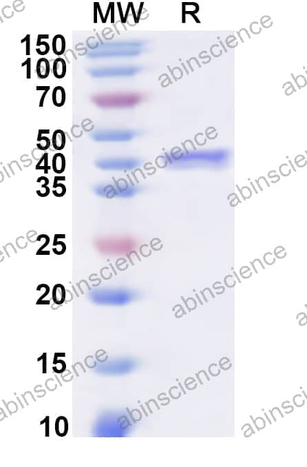 Human PAFAH1B1 Recombinant Protein (N-His)