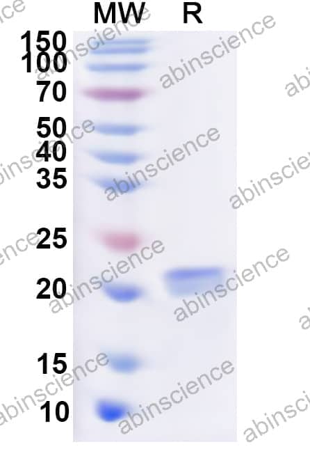 Human GUCA1A Recombinant Protein (N-His)