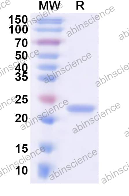 Human PTDSS1 Recombinant Protein (N-His-KSI)