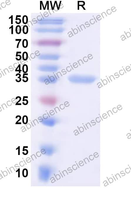 Human ASPA Recombinant Protein (N-His)