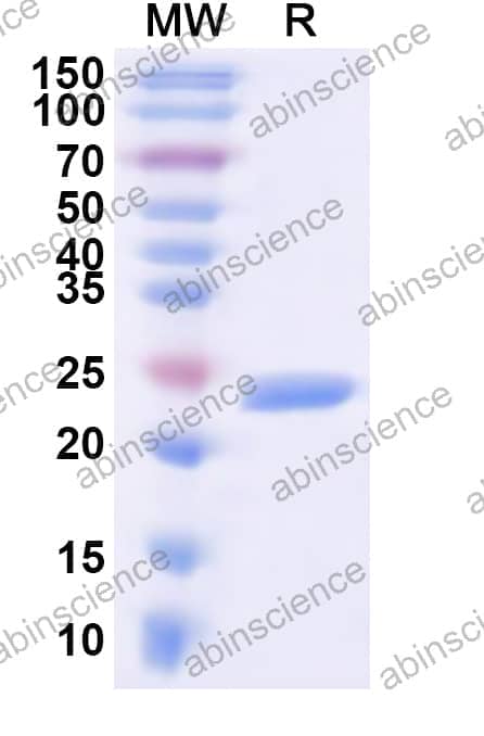 Human KCNJ5 Recombinant Protein (N-His)