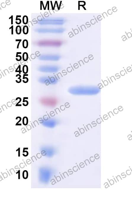 Human ARFIP1 Recombinant Protein (N-His)