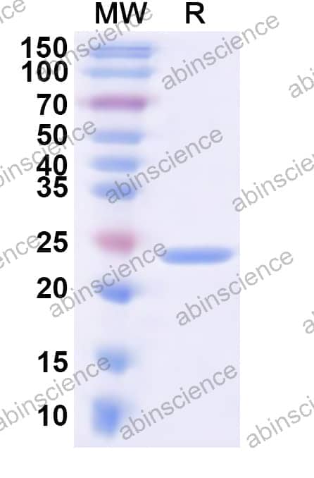Human KCNJ6 Recombinant Protein (N-His)