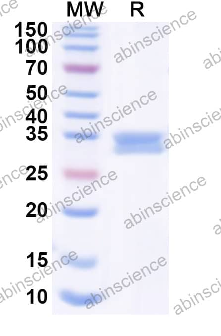Human LPAR6 Recombinant Protein (N-GST & C-His)