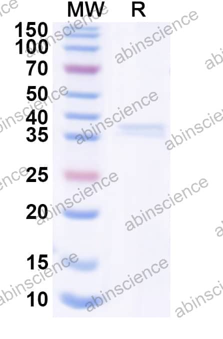Human TRAPPC10 Recombinant Protein (N-His)