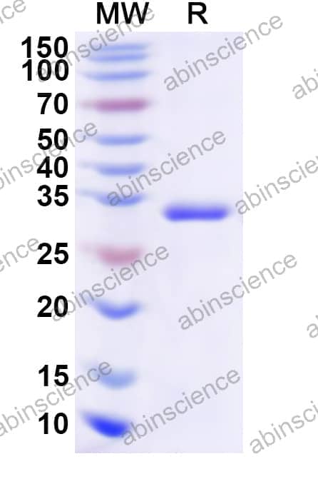 Human HNMT Recombinant Protein (N-His)