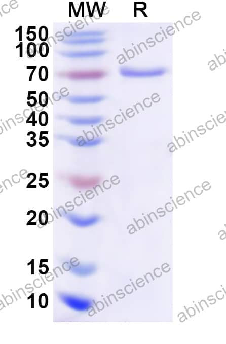 Human EVX1 Recombinant Protein (N-His-KSI)