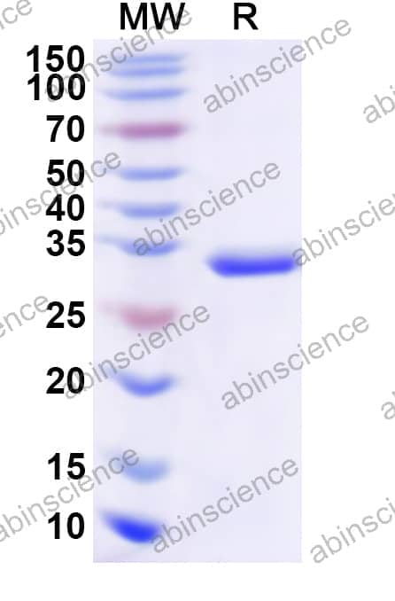 Human TTPA Recombinant Protein (N-His)