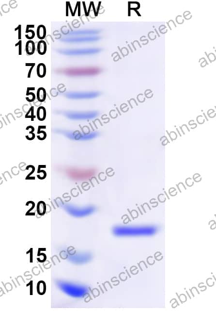 Human LHX2 Recombinant Protein (N-His)