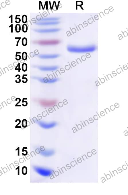 Human ALDH9A1 Recombinant Protein (N-His)