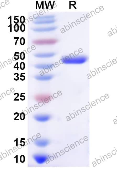 Human HARS2 Recombinant Protein (N-His)