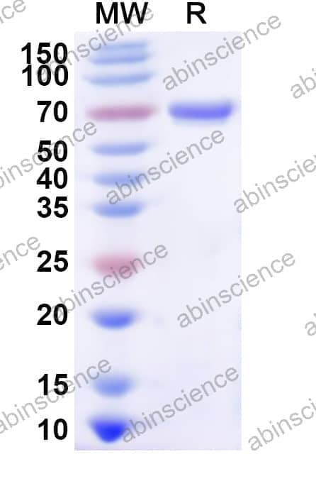 Human CDKN1C Recombinant Protein (N-His-KSI)