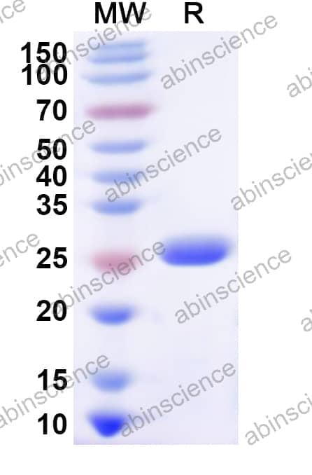 Human PSMB3 Recombinant Protein (N-His)