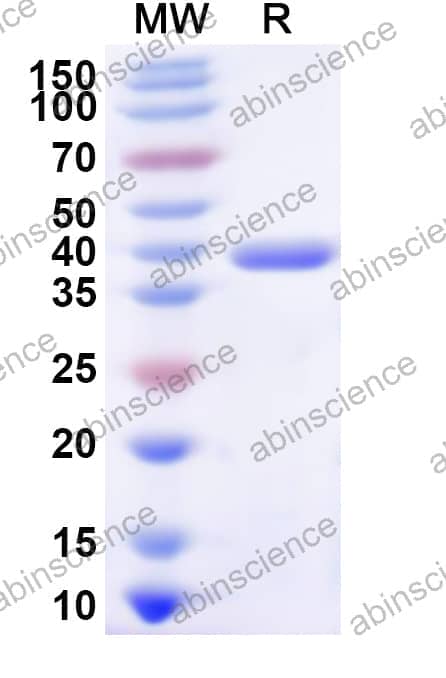 Human SARS1 Recombinant Protein (N-His)