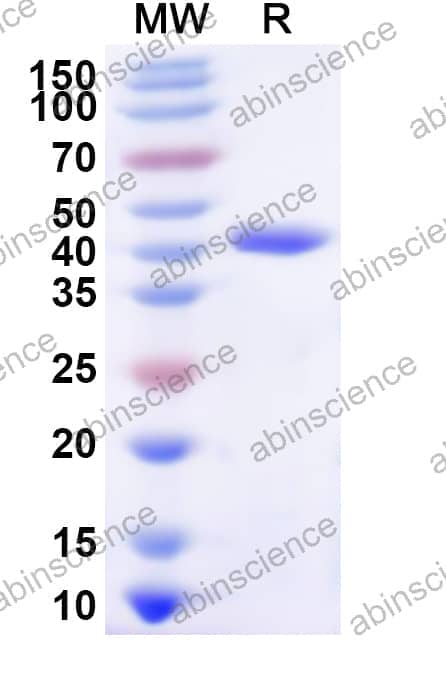 Human CDK7 Recombinant Protein (N-His)