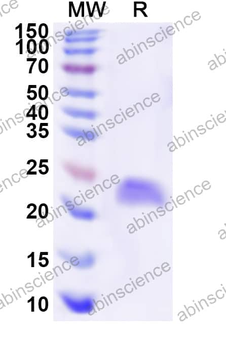 Human CSRP3 Recombinant Protein (N-His)