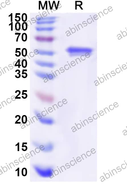 Human PPOX Recombinant Protein (N-His)