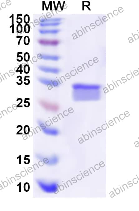 Human HTR6 Recombinant Protein (N-His-KSI)
