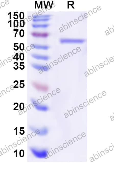 Human HLCS Recombinant Protein (N-His)