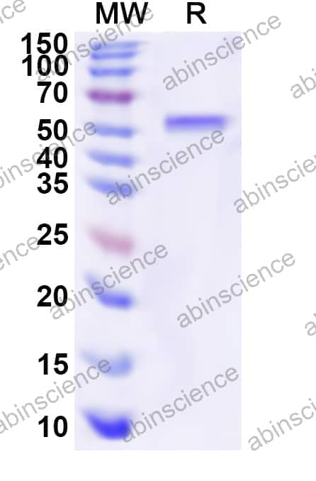 Human HOXD13 Recombinant Protein (N-His-KSI)