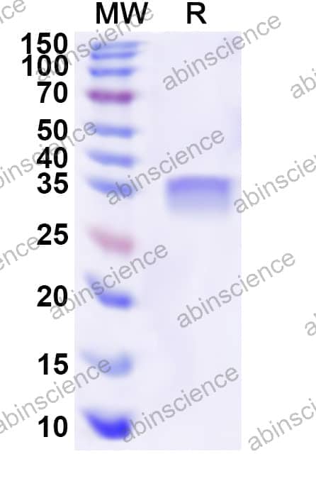 Human ID4 Recombinant Protein (N-His-KSI)