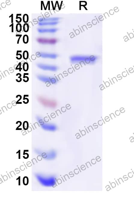Human NUP214 Recombinant Protein (N-His)