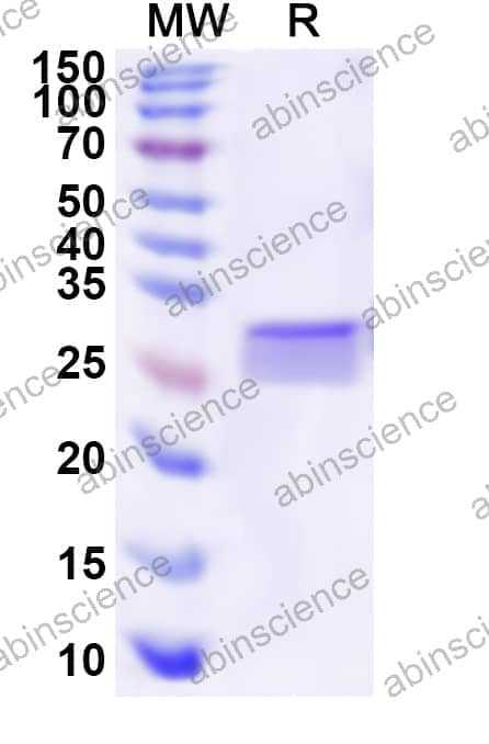 Human KCNJ1 Recombinant Protein (N-His)