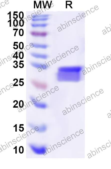 Human TUB Recombinant Protein (N-His)