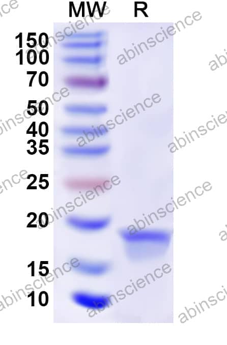 Human SCTR Recombinant Protein (N-His)