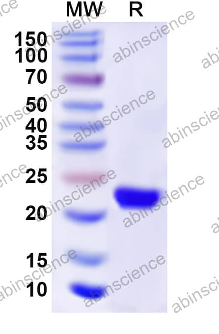 Human ST13 Recombinant Protein (N-His)