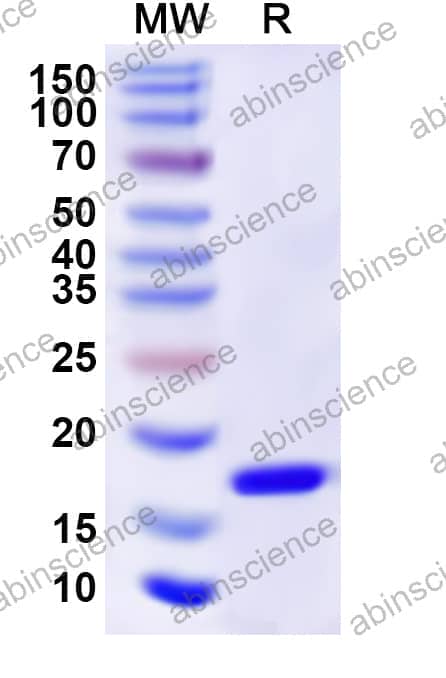 Human RAD52 Recombinant Protein (N-His)