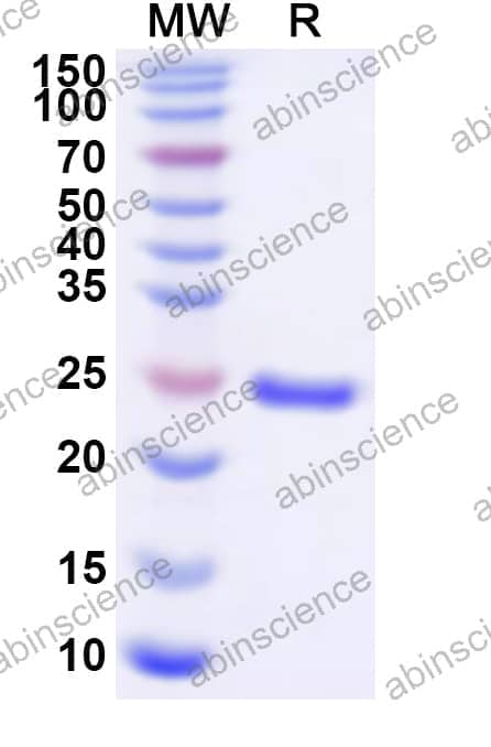 Human PSMB4 Recombinant Protein (N-His)