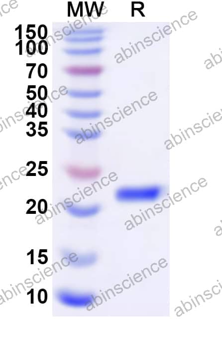 Human NFYB Recombinant Protein (N-His)