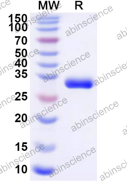 Human PRKCH Recombinant Protein (N-His)