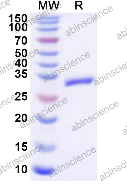Human CLCN6 Recombinant Protein (N-His)