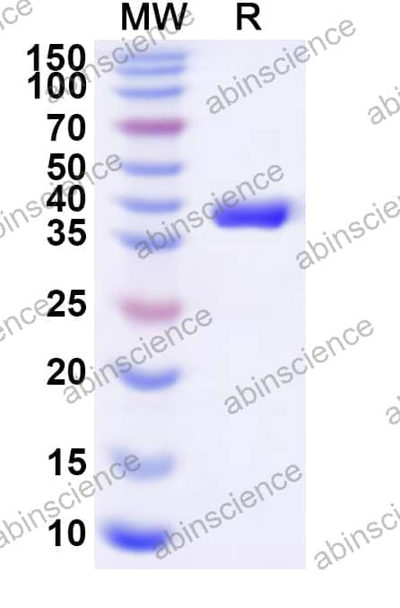 Human IDH3G Recombinant Protein (N-His)