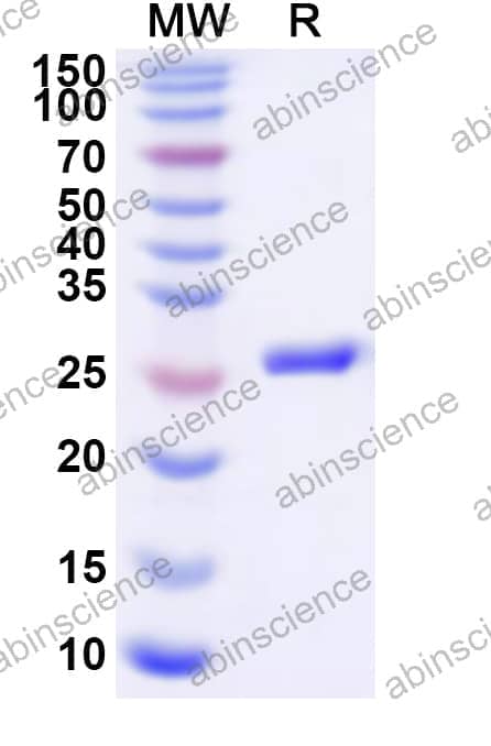Human GPR143 Recombinant Protein (N-His-KSI)