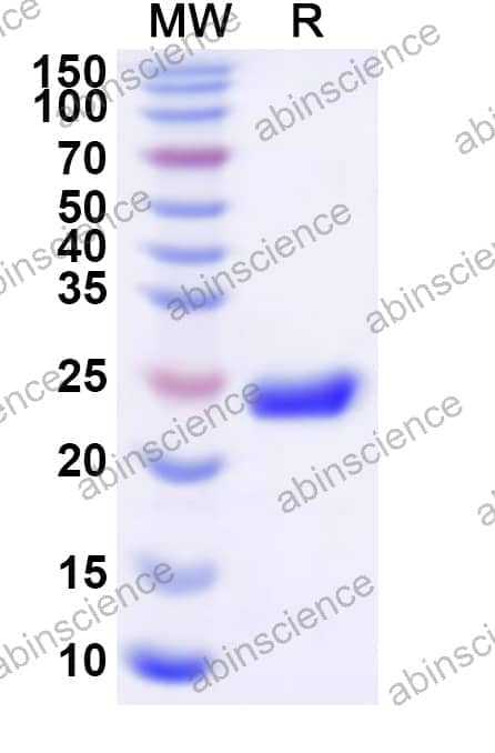 Human CLCNKA Recombinant Protein (N-His)
