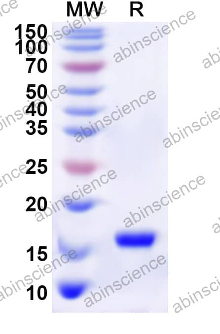 Human GDF1 Recombinant Protein (N-His)