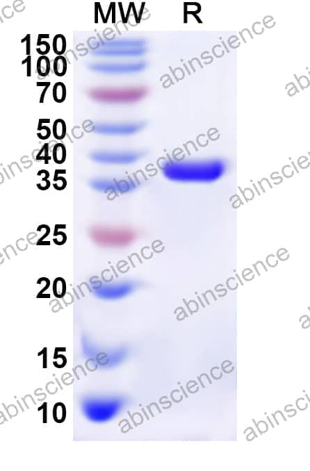 Human CLCN2 Recombinant Protein (N-His)