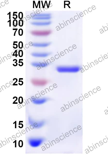 Human TKTL1 Recombinant Protein (N-His)