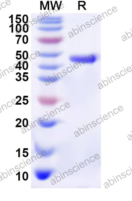 Human RPA1 Recombinant Protein (N-His)
