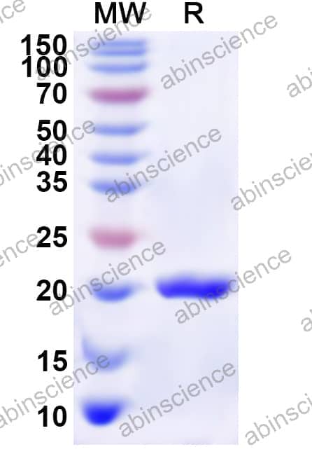 Human P2RY4 Recombinant Protein (N-His-KSI)