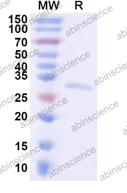 Human MTIF2 Recombinant Protein (N-His)